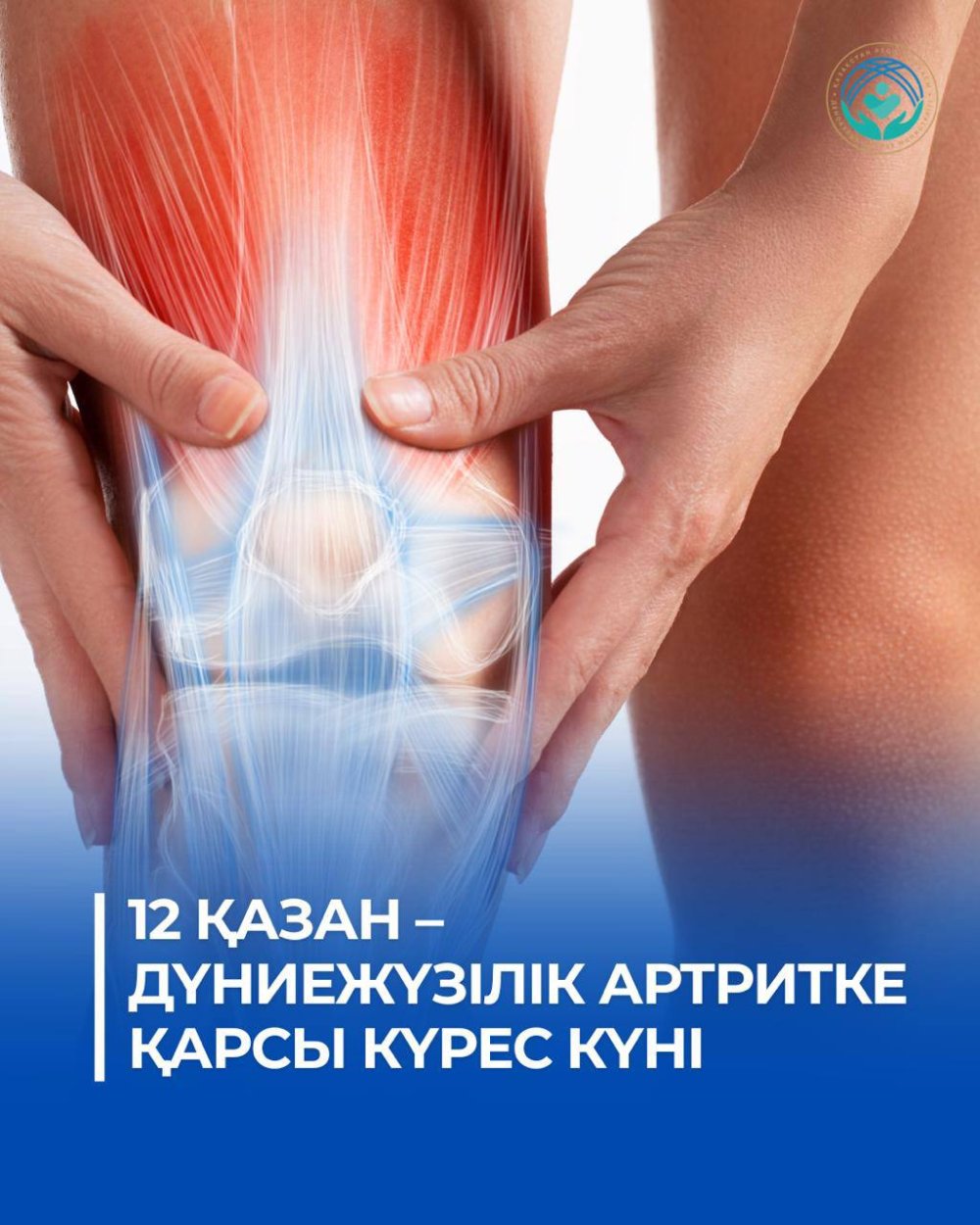 12 ҚАЗАН – ДҮНИЕЖҮЗІЛІК АРТРИТКЕ ҚАРСЫ КҮРЕС КҮНІ