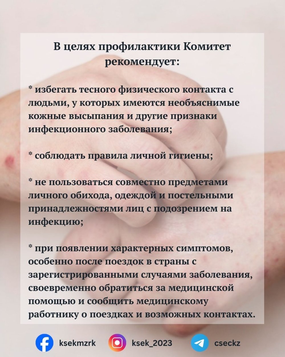 Маймыл шешегі бойынша эпидемиологиялық жағдайды бақылауда — Фотосурет 2
