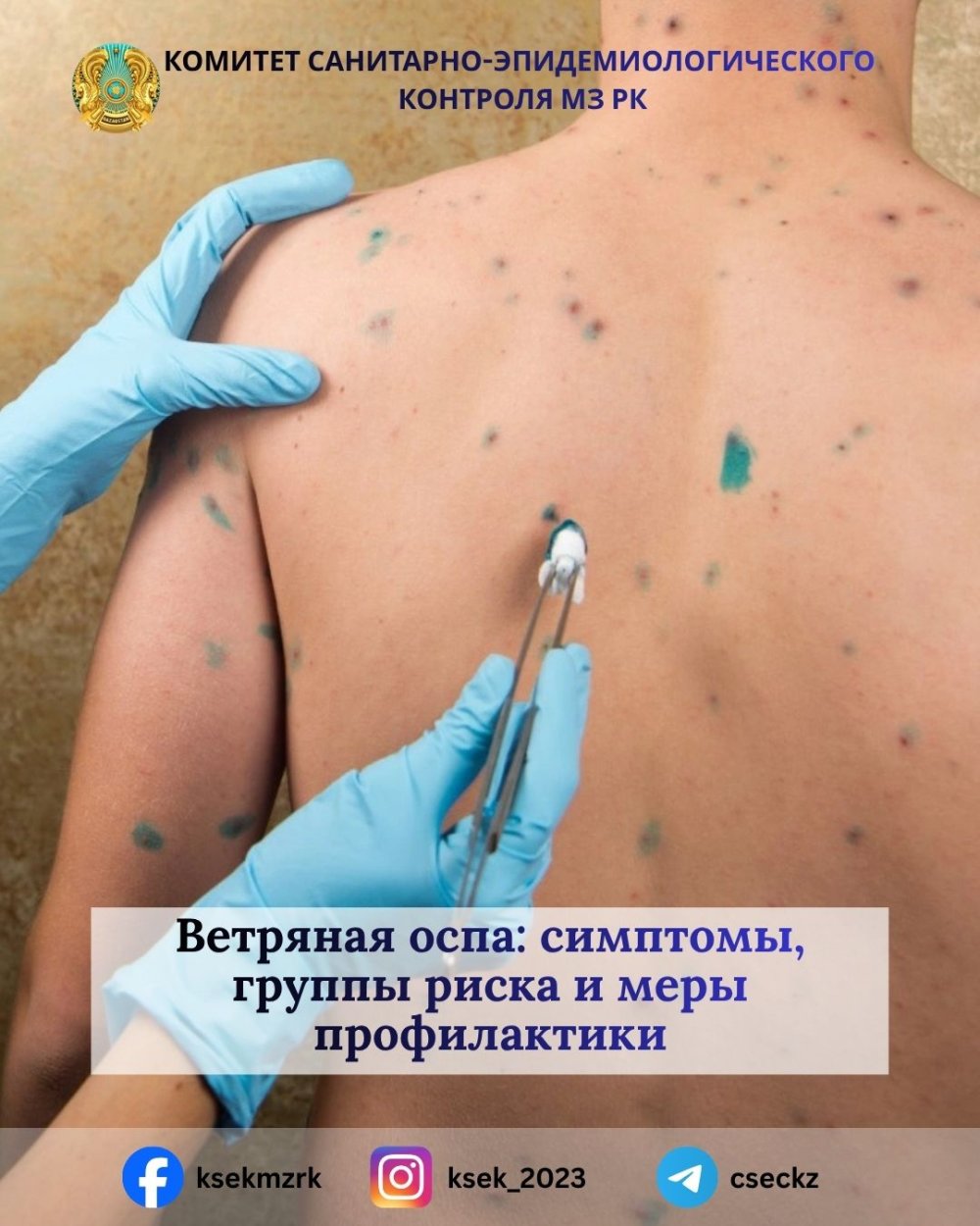 Желшешек: белгілері, қауіп топтары және алдын алу шаралары