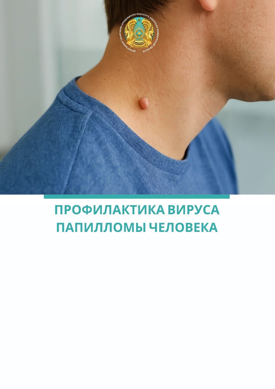 Профилактика вируса папилломы человека