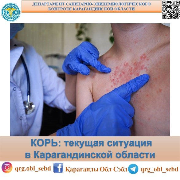 КОРЬ: текущая ситуация в Карагандинской области
