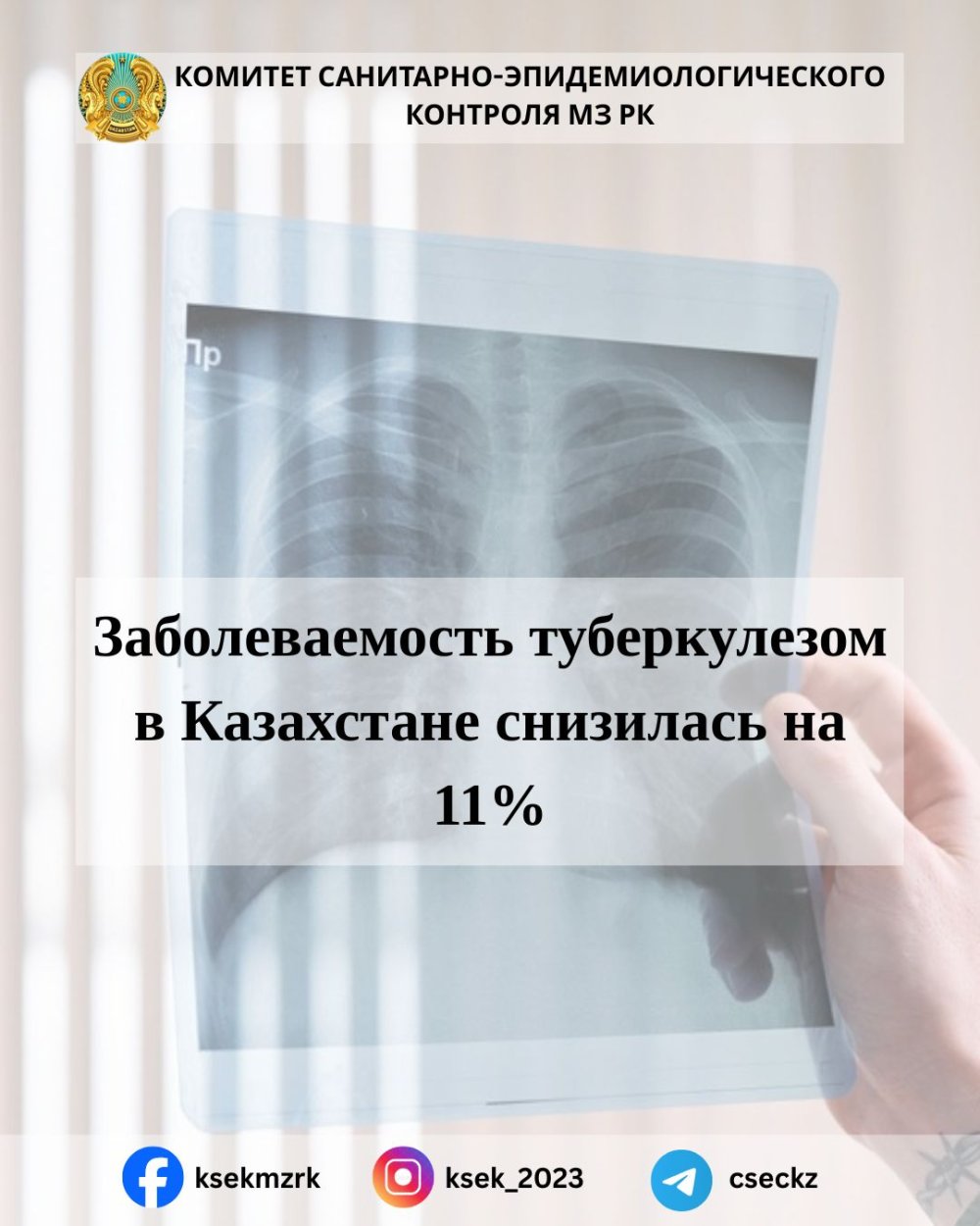 Заболеваемость туберкулезом в Казахстане снизилась на 11%